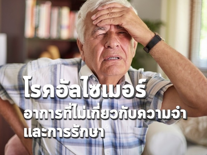 โรคอัลไซเมอร์: อาการที่ไม่เกี่ยวกับความจำและการรักษา