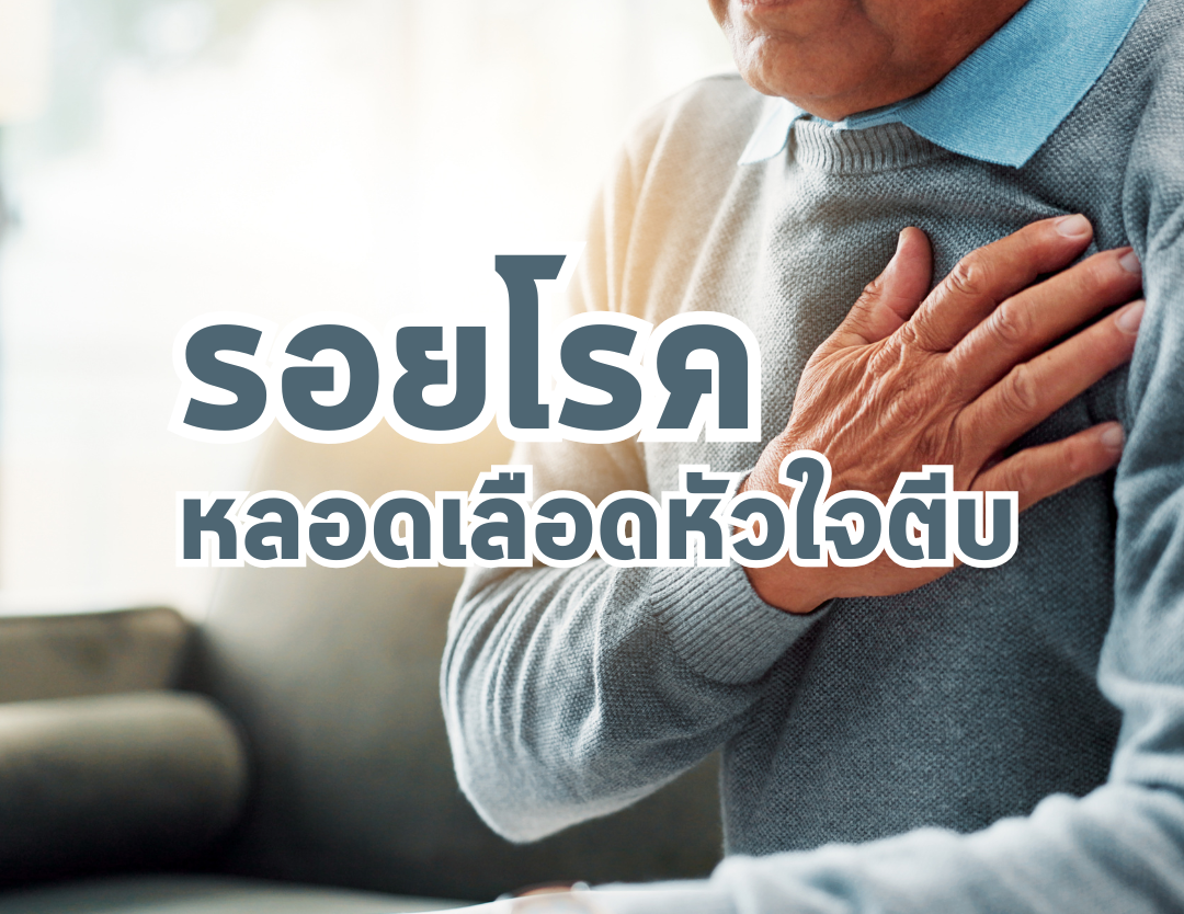 สัญญาณเตือนภัย "รอยโรค" หลอดเลือดหัวใจตีบ